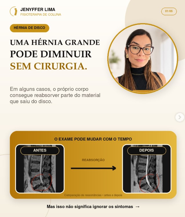 Uma hérnia grande pode diminuir sem cirurgia